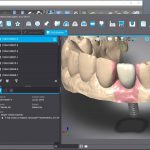 codiagnostix-implant-planning-software-2