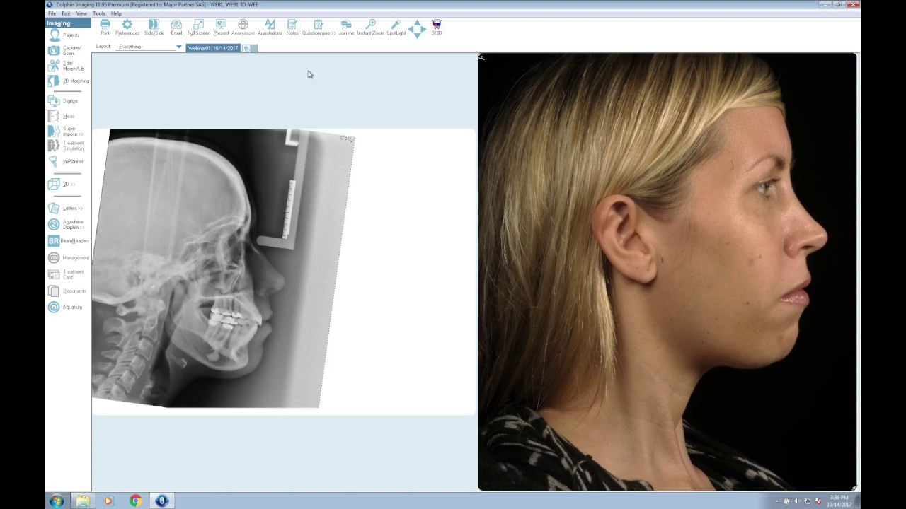 Как загрузить dicom файлы в dolphin imaging