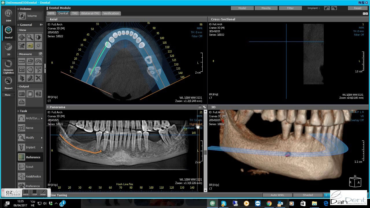 Ondemand3d cd viewer не запускается на windows 10