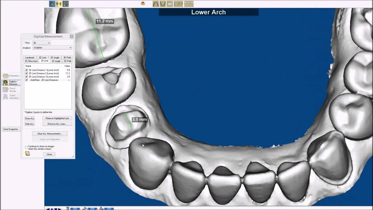 patterson dental dolphin imaging