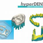 hyperdent_Additive_Manufacturing_2017