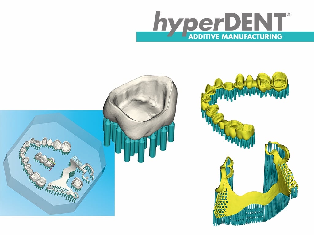 hyperdent_Additive_Manufacturing_2017