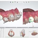 3Shape_OrthoSystem