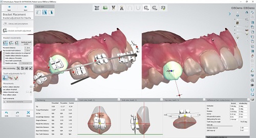 3Shape_OrthoSystem