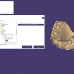 01-Load-DICOM-Data-and-start-the-guided-workflow