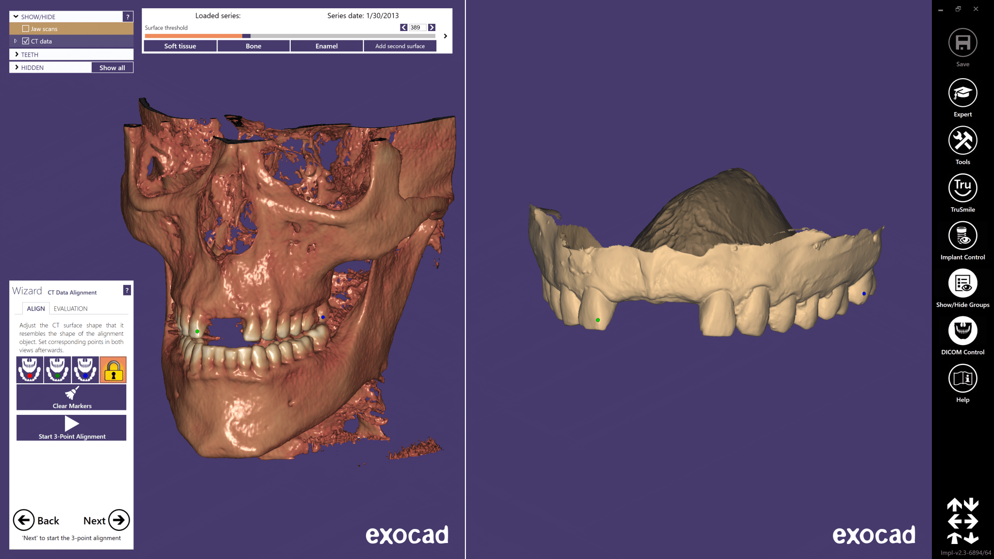 02-Match-DICOM-Data-with-optical-scan-data