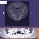 04-Define-panoramic-curve