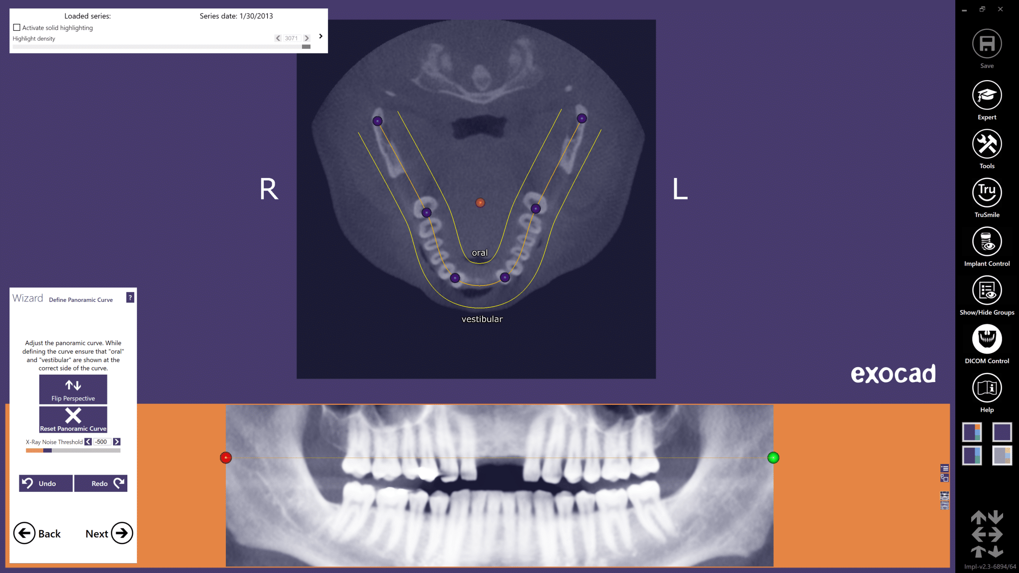 04-Define-panoramic-curve