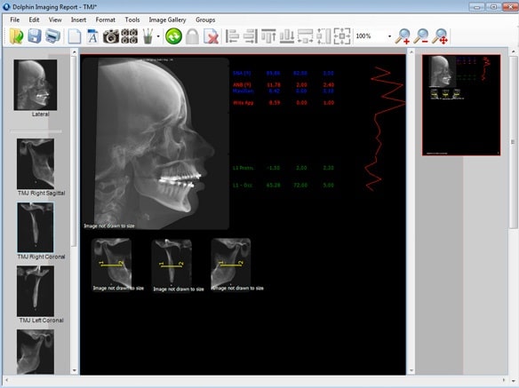 3Dreport