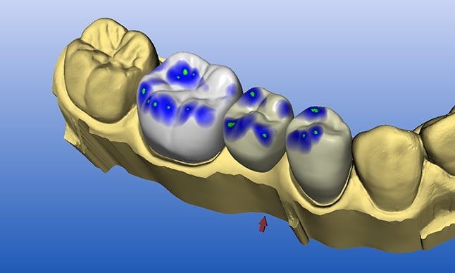 Cerect-Connect-process-8