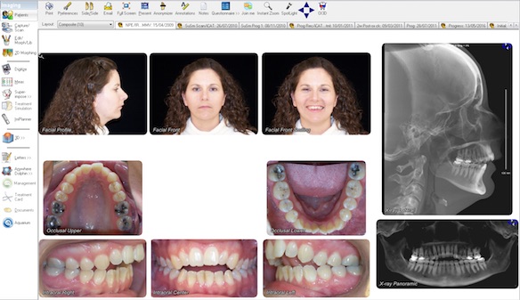 Как загрузить dicom файлы в dolphin imaging