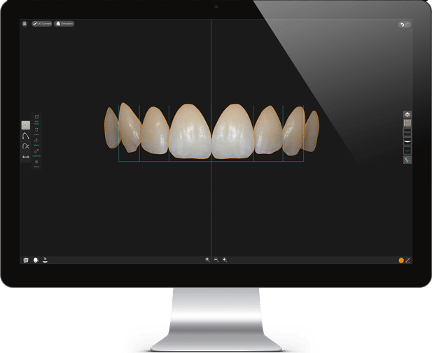 smile designer pro