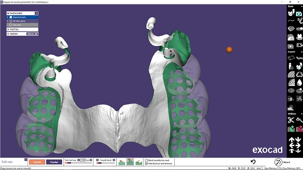 exocad dental crack download