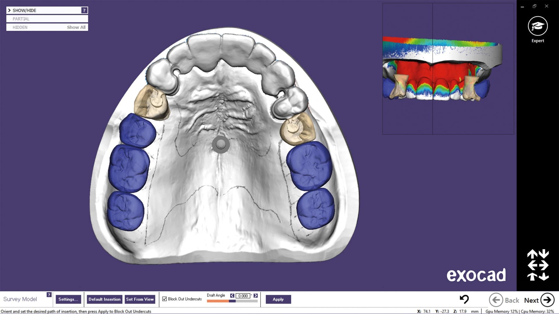 exocad dental crack download