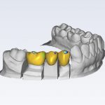 planmeca-plancad-premium-customisable-software