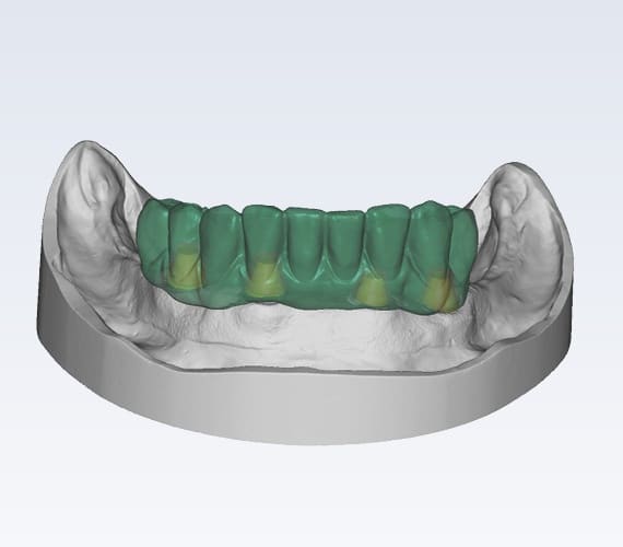 planmeca-plancad-premium-software-open-stl-files