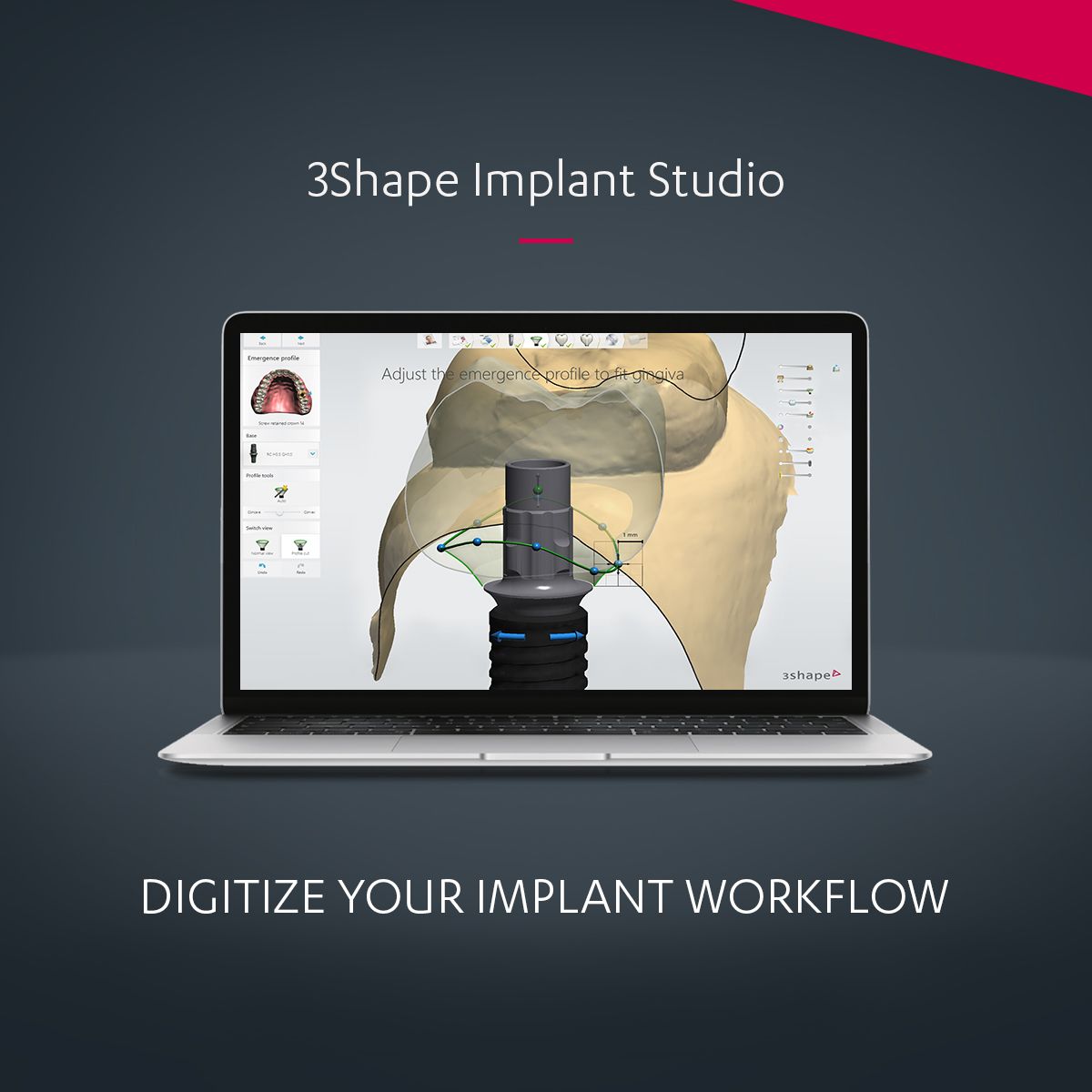 Open Graph Implant Studio