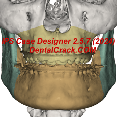 IPS Case Designer 2.5.7 2024 year full crack download