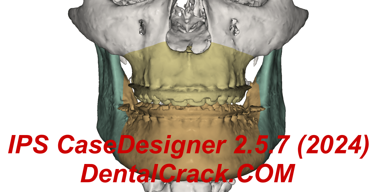 IPS Case Designer 2.5.7 2024 year full crack download