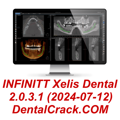 INFINITT Xelis Dental 2 2024 year FULL crack patch download license activated keygen dongle