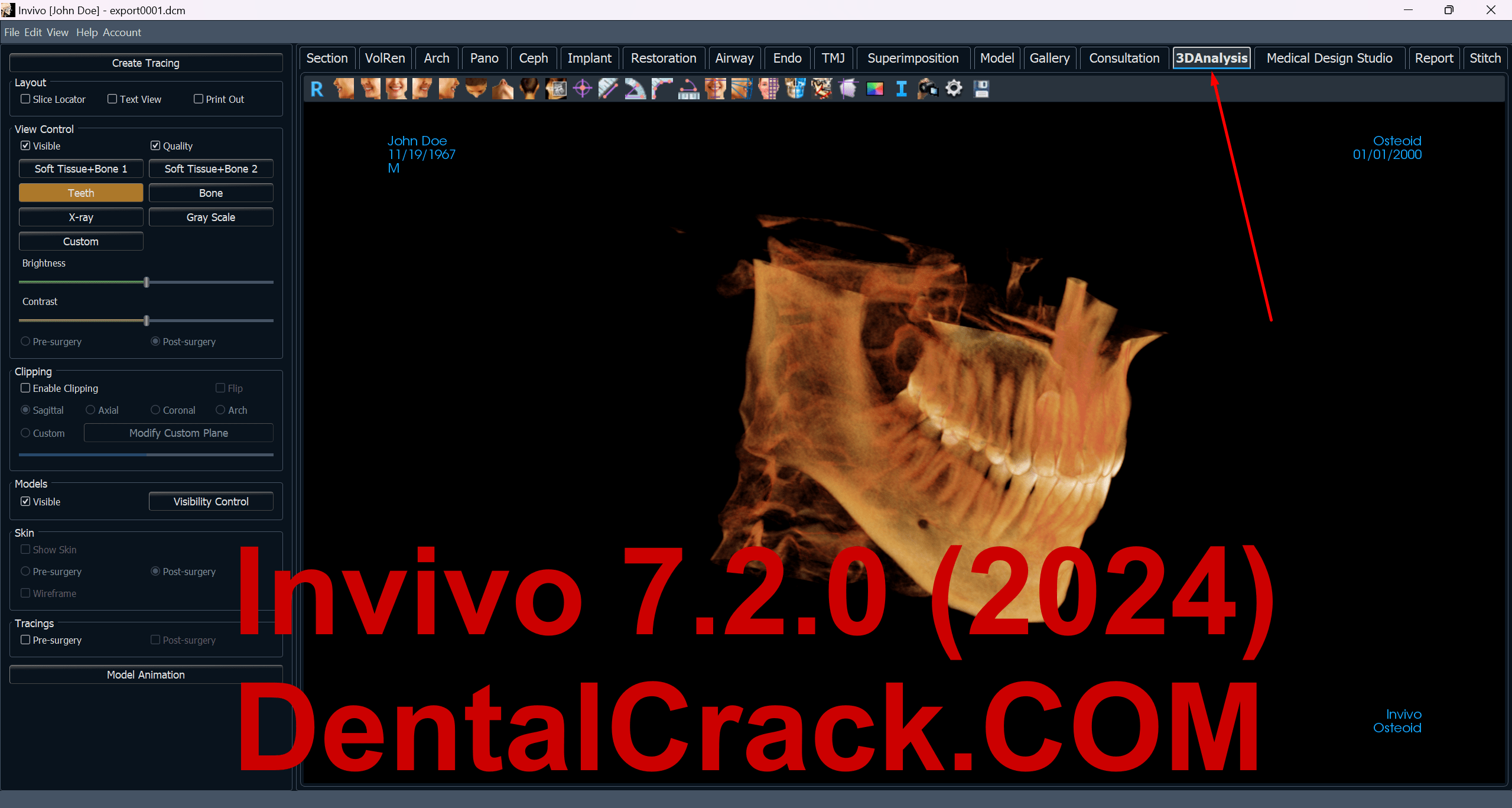 Invivo 7.2 (2024 year) full crack download