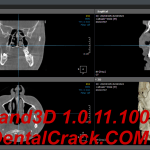 OnDemand3D 1.0.11.1007 (2024 year) full crack download