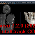 Invivo 7.2 (2024 year) full crack download