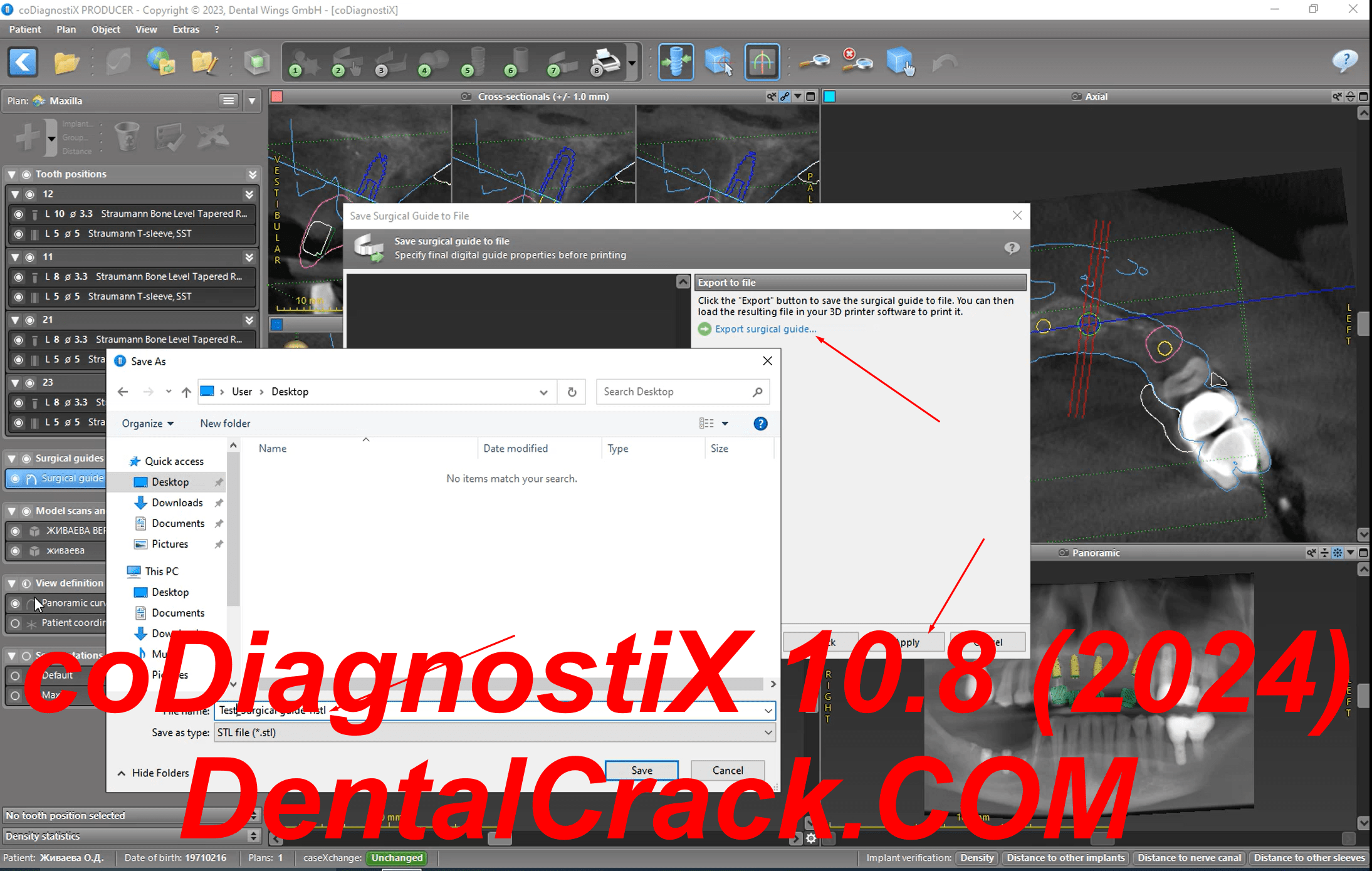 coDiagnostiX 10.8 2024 year FULL crack patch download license activated keygen dongle