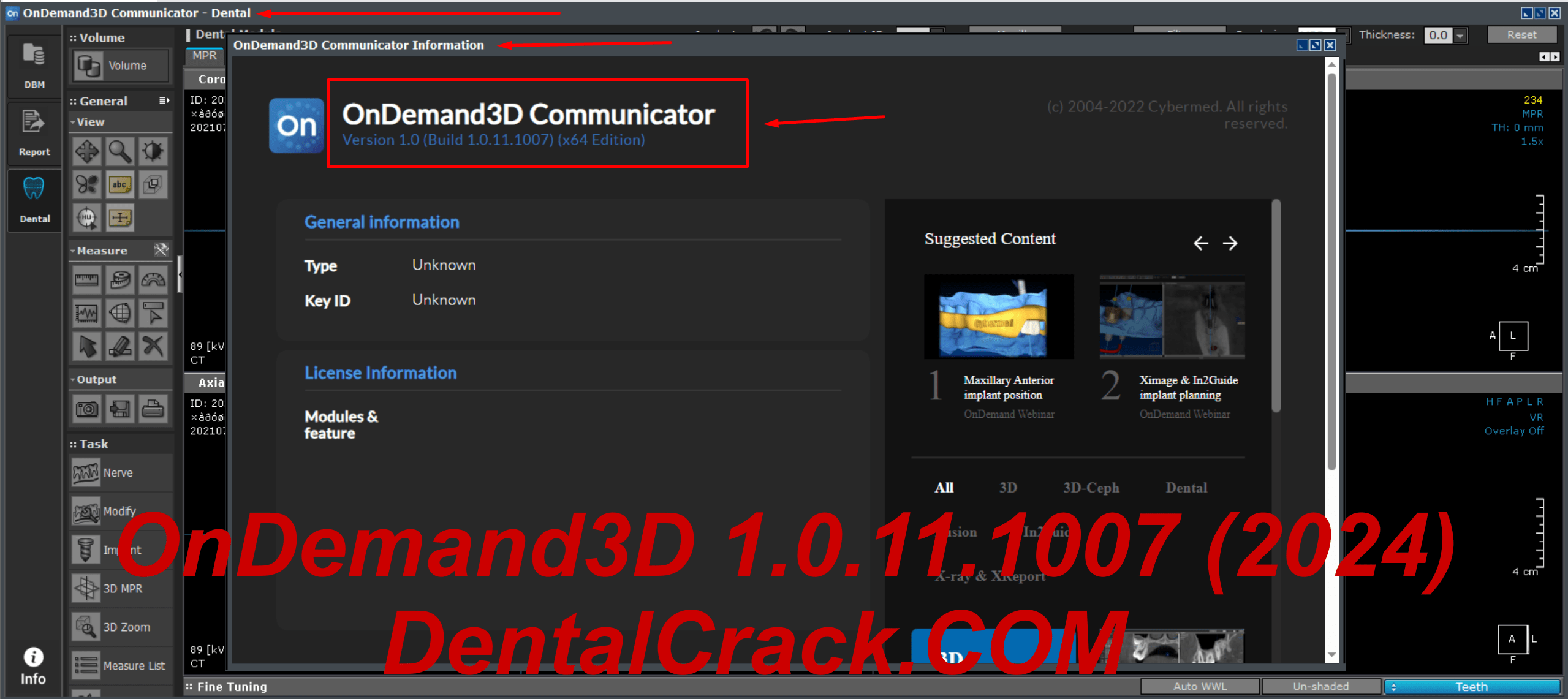 OnDemand3D 1.0.11.1007 (2024 year) full crack download