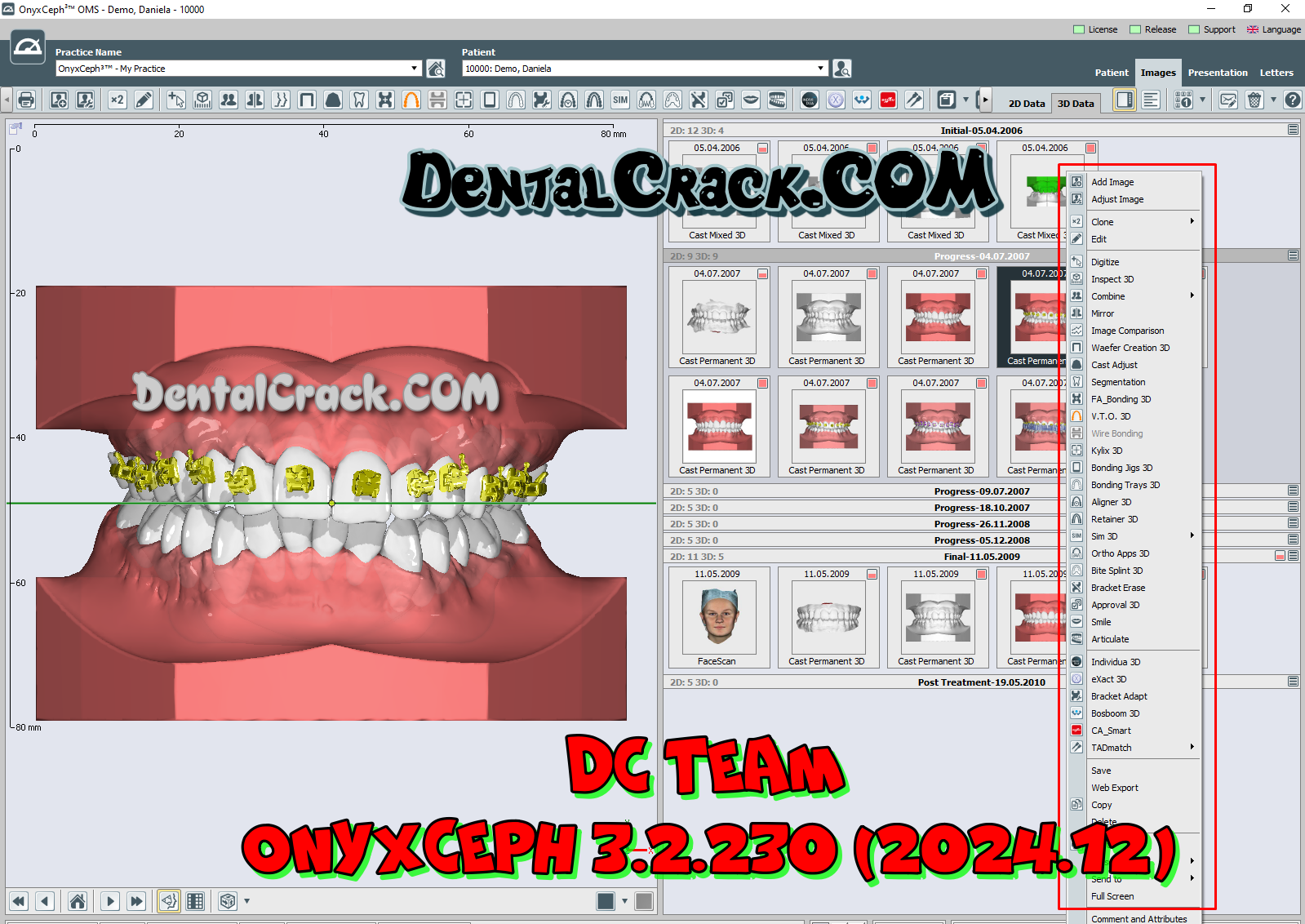 OnyxCeph 3.2.230 (2024.12) FULL crack