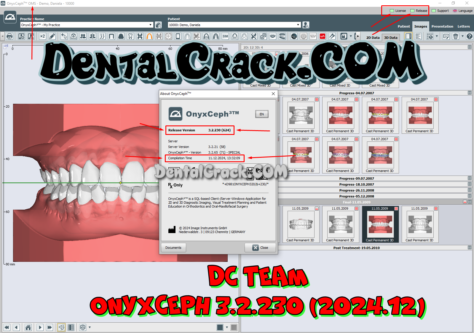 OnyxCeph 3.2.230 (2024.12) FULL crack