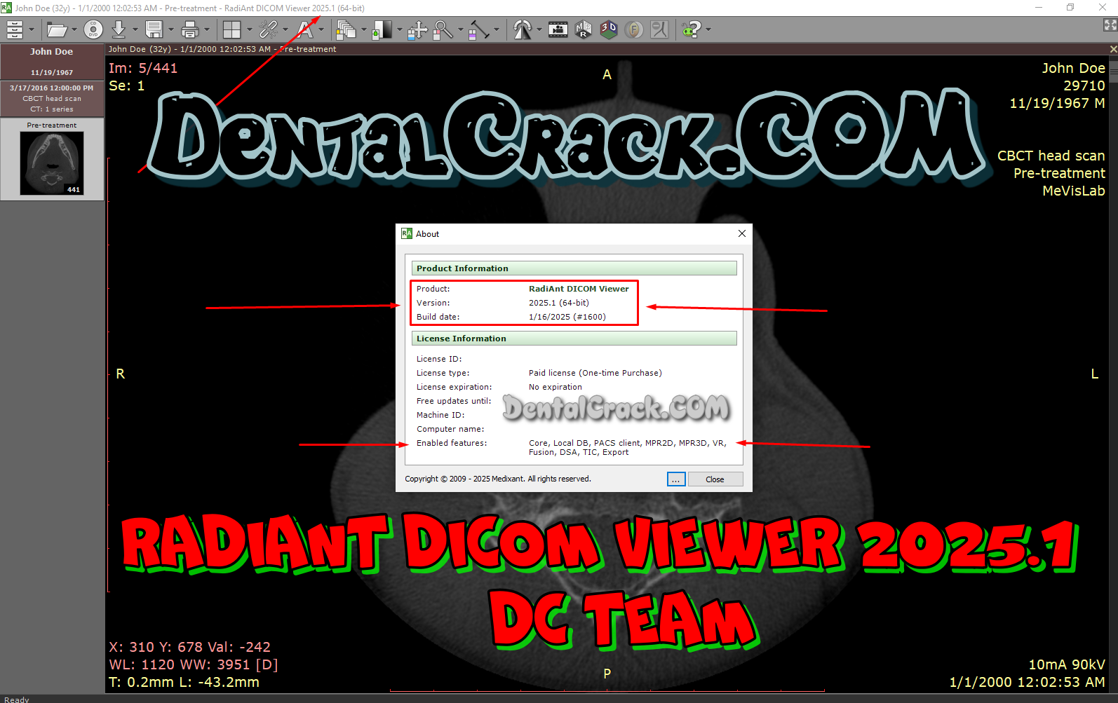 RadiAnt DICOM Viewer crack