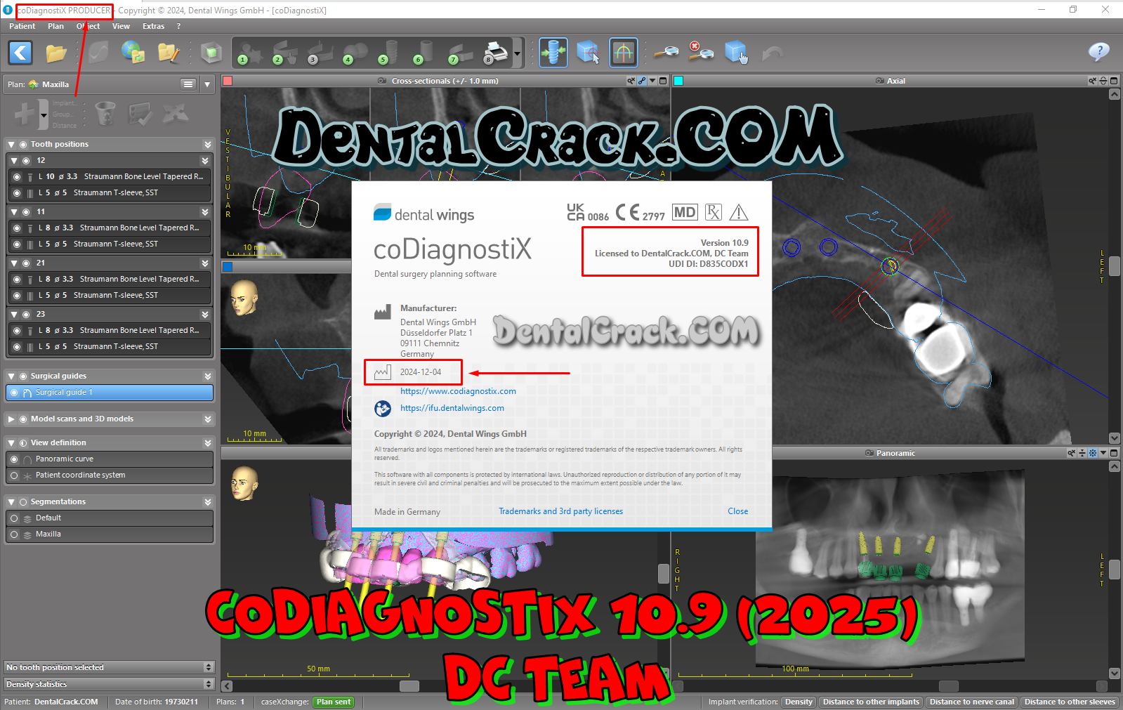 coDiagnostiX 10.9 (2025) FULL crack