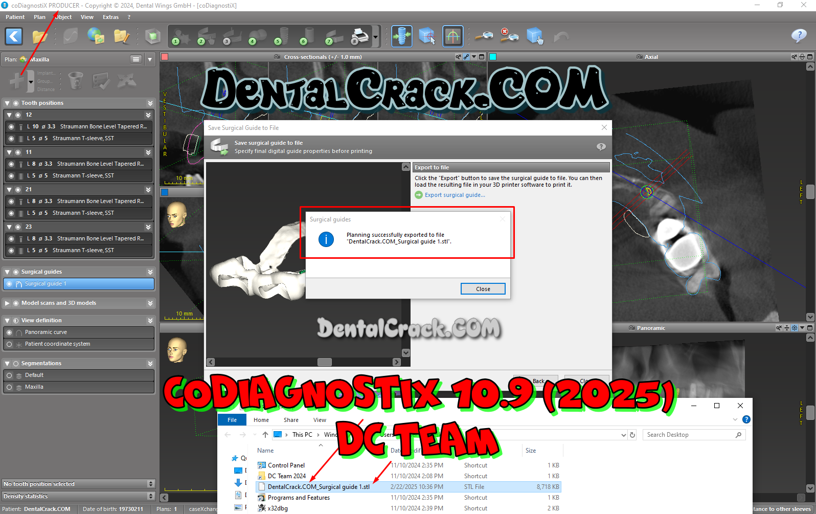 coDiagnostiX 10.9 (2025) FULL crack