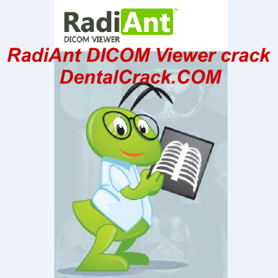 RadiAnt DICOM Viewer crack