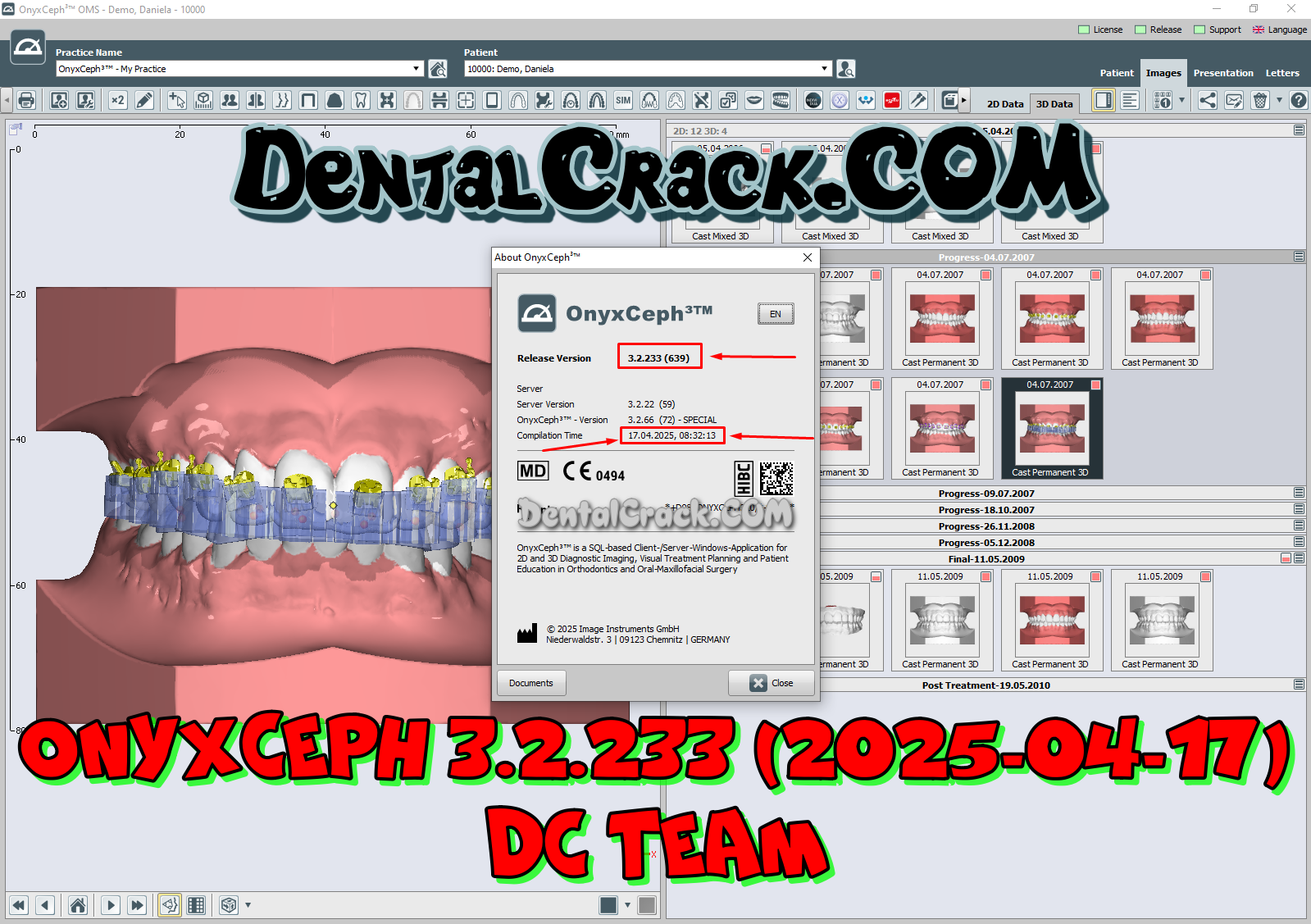 OnyxCeph 3.2.233 (2025) crack download