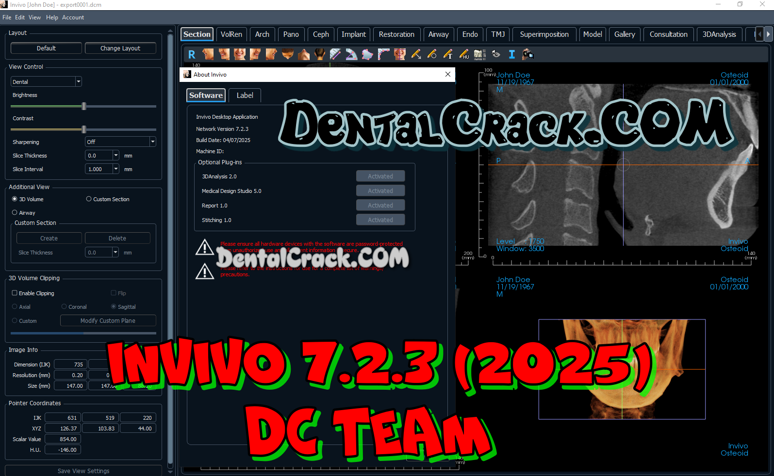 Invivo 7.2.3 crack download