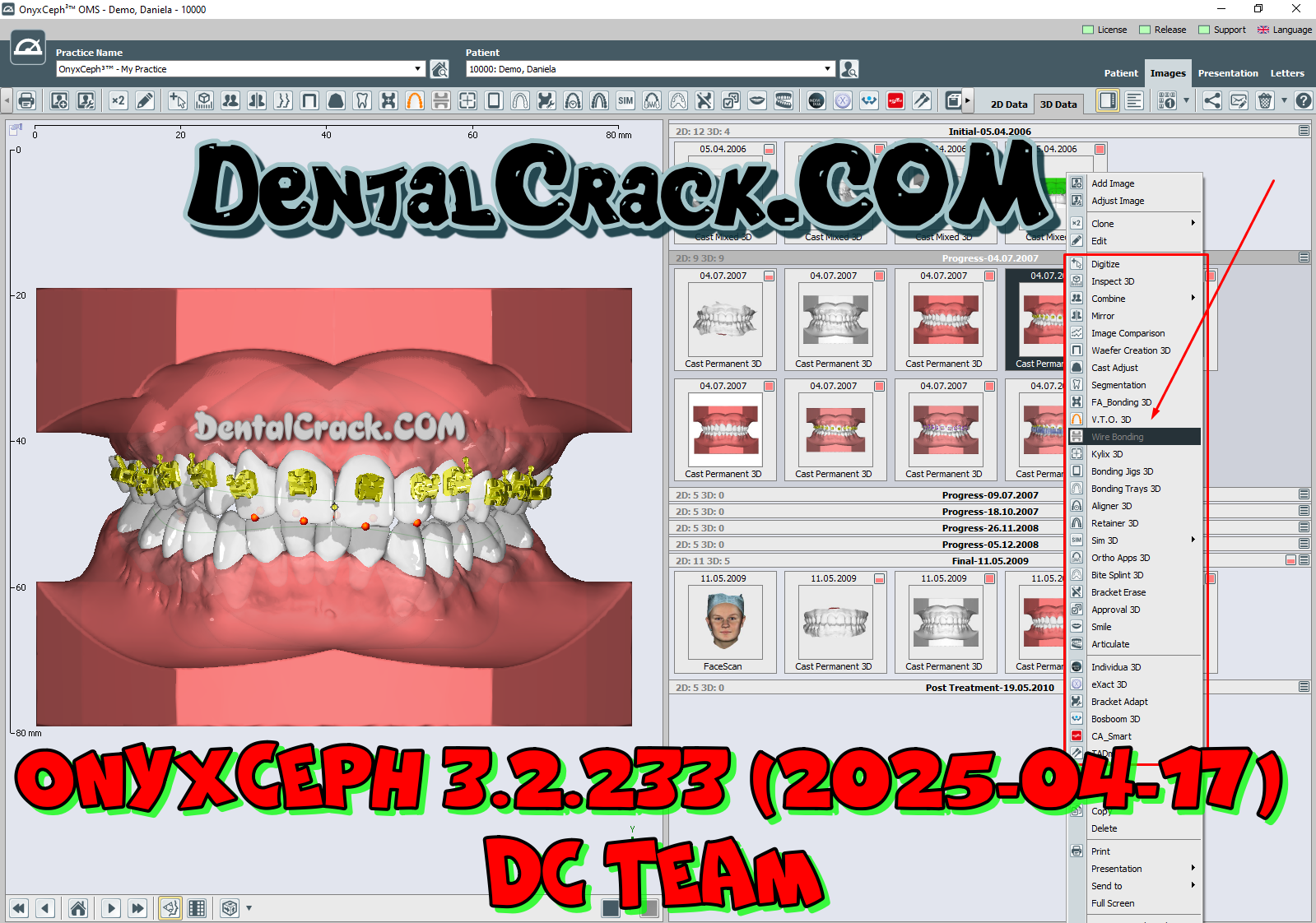 OnyxCeph 3.2.233 (2025) crack download