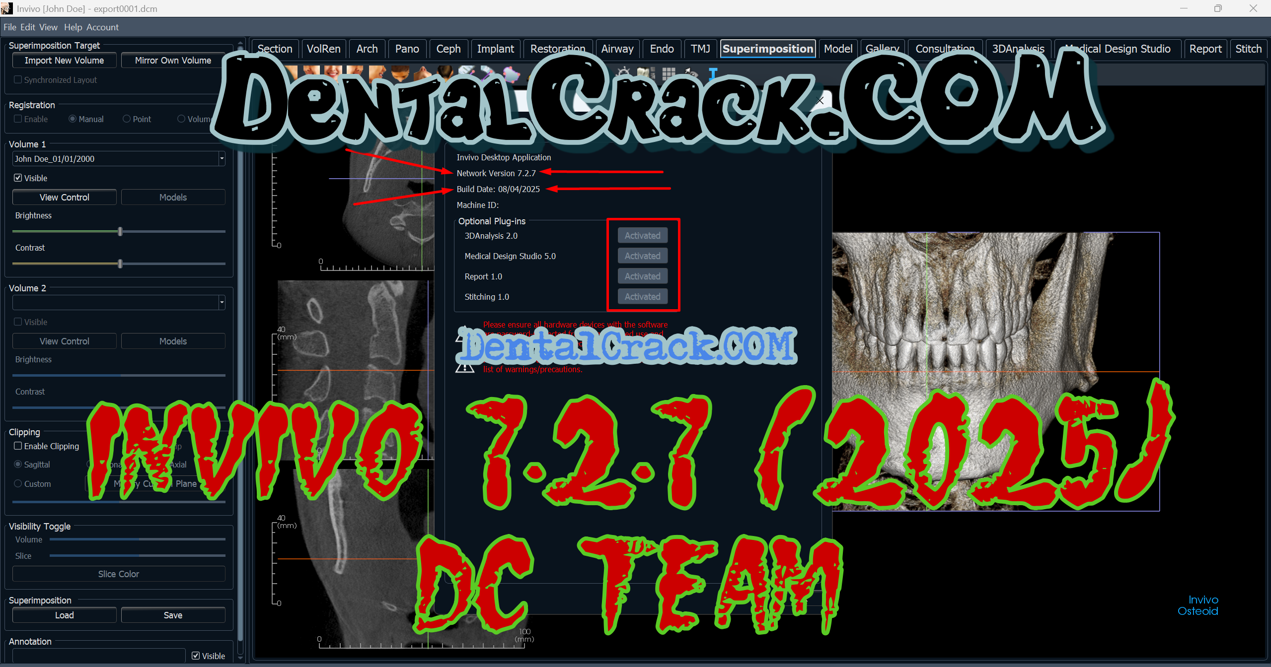 Invivo 7.2.7 FULL crack